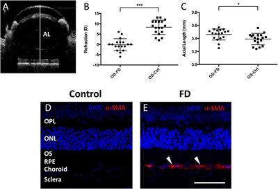 RNA-sequencing analysis reveals the long noncoding RNA profile in the mouse myopic retina